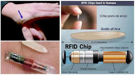 rfid chip 666 indonesia|chip 666 ke badan.